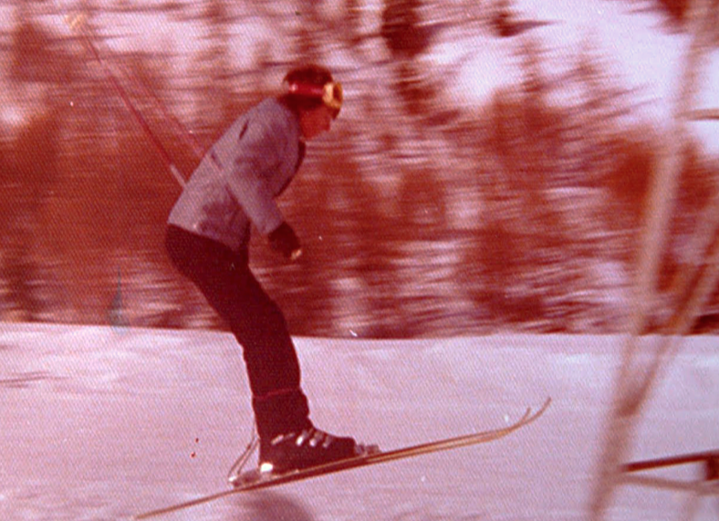 Breaking a Leg: The Reality of Skiing Adventures in 1975